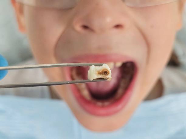 Best Emergency Dental Care for Trauma or Injury in Mannington, WV